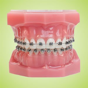 Dental Care